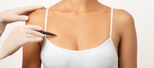 What to Expect from an Exosome Breast Lift?  The MD Wellness Center in Tomball, TX 